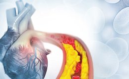 Kolesterolü ilaçsız düşürme yolları