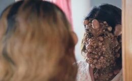 Binlerce tümörle yaşıyordu… Ne nefes alabiliyor ne de yürüyebiliyordu